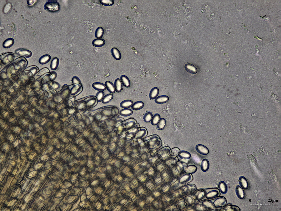 Quetschpräparat der mit Sporen gefüllten Schläuche (Asci) in Wasser mit ausgetretenen Sporen