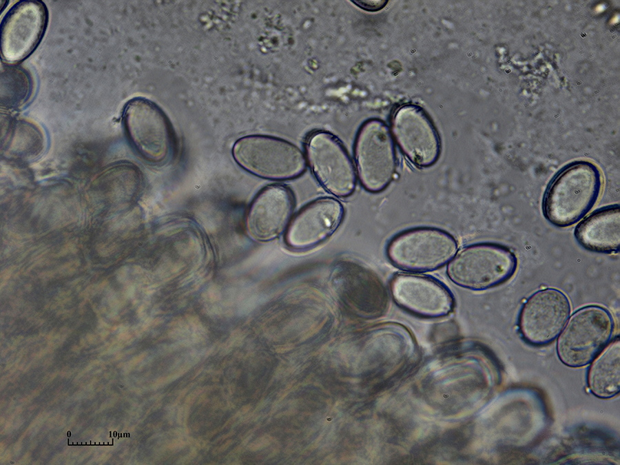 Vergrößerte Sporen des Buchenwaldbecherlings (Peziza arvenensis) in Wasser (Quetschpräparat). Sporen 17 x 9 µm