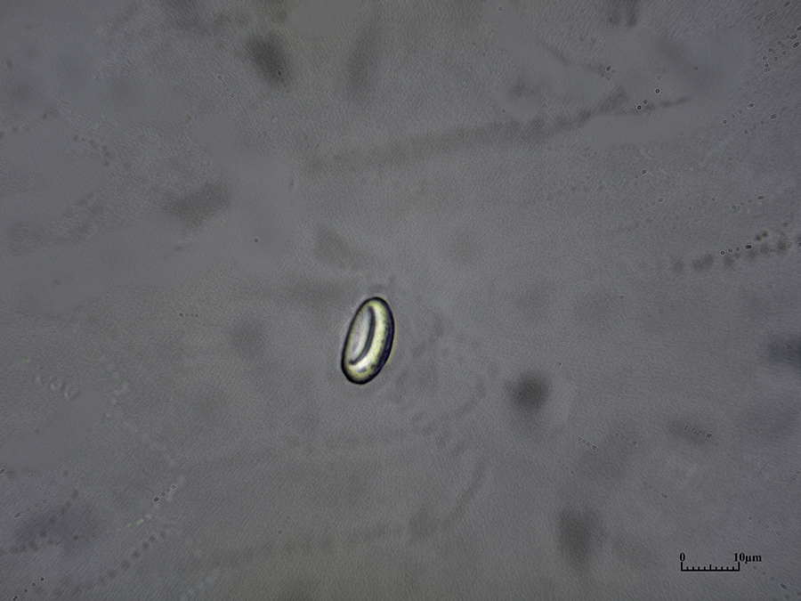 Spore des Buchenwaldbecherlings (Peziza arvenensis) in einem Gemisch aus Glycerin und Wasser