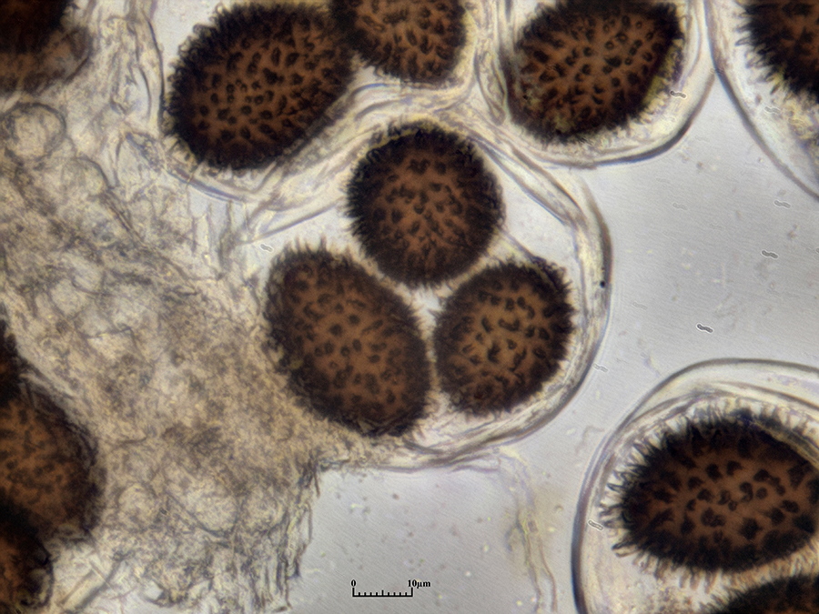 Sporen des Perigord-Trüffel (Tuber melanospora) im Ascus