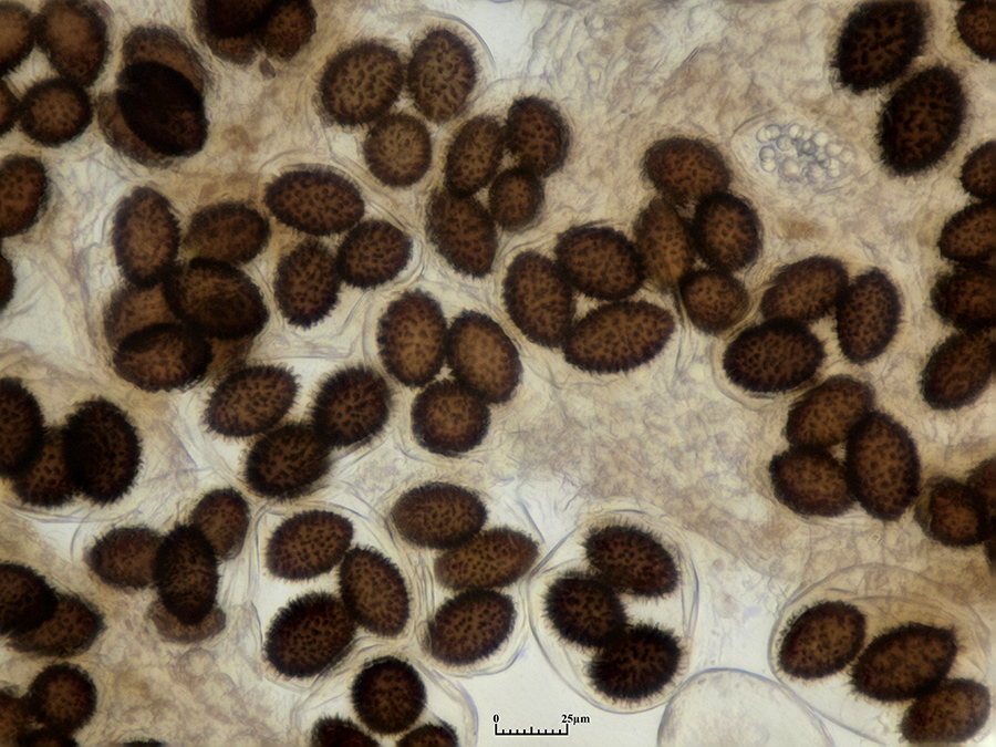 Sporen des Perigord-Trüffel (Tuber melanosporum) in den Asci in der Übersicht