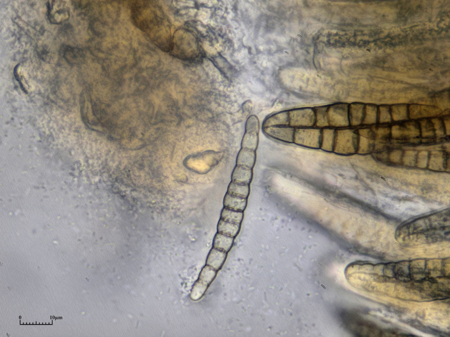 Spore des Zugespitzten Kugelpilzes (Leptospaeria acuta)