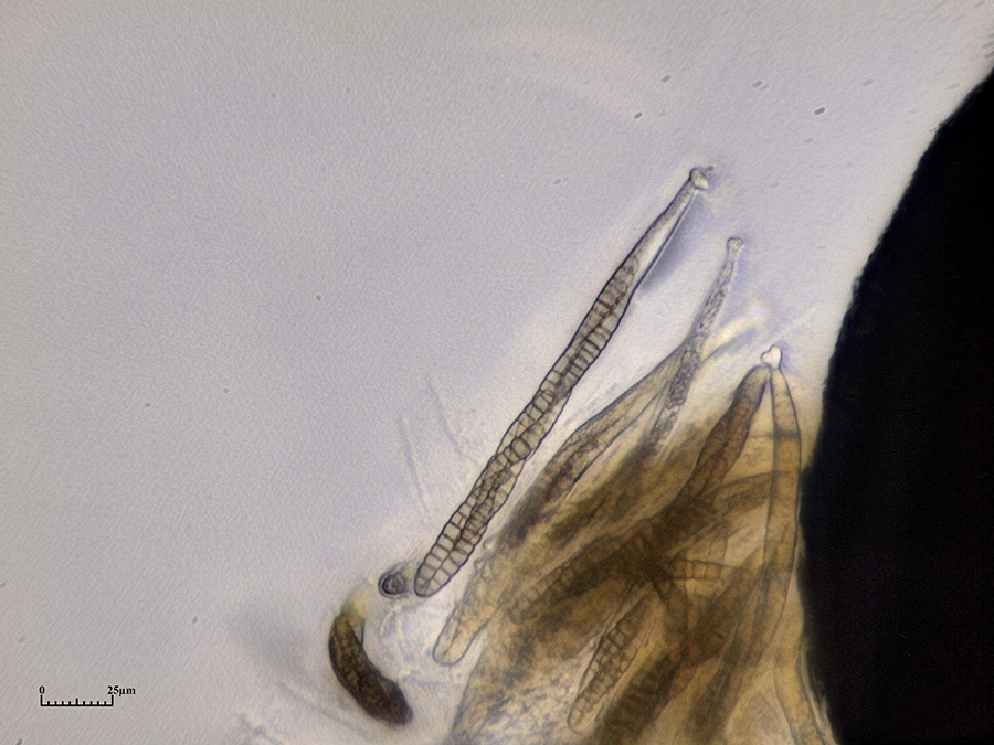 Sporen im Schlauch des Zugespitzten Kugelpilzes (Leptospaeria acuta)