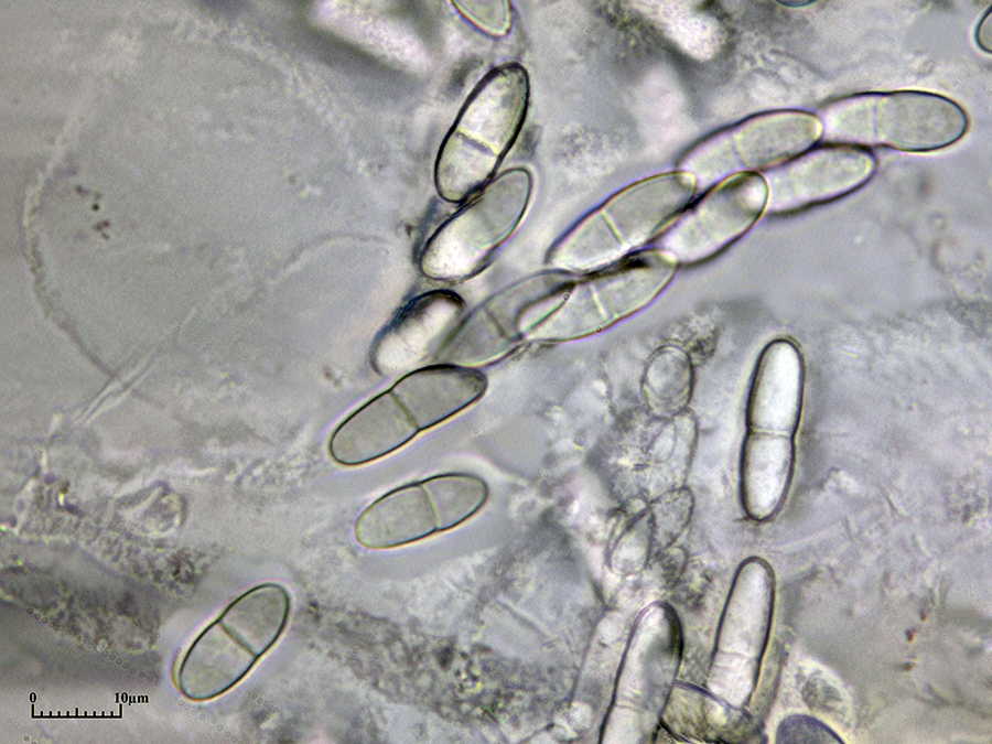 Sporen des Rotpustelpilzes (Nectria cinnabarina)