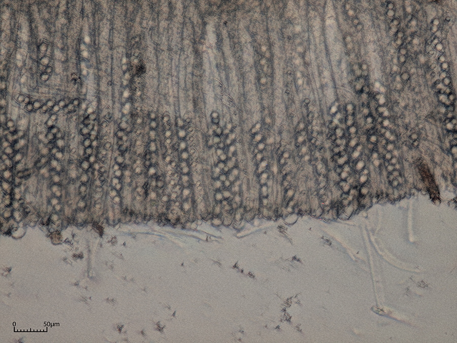 Schlauch mit Sporen Mikroskopobjektiv 20x<br />die Sporen sind nicht kaum zu erkennen