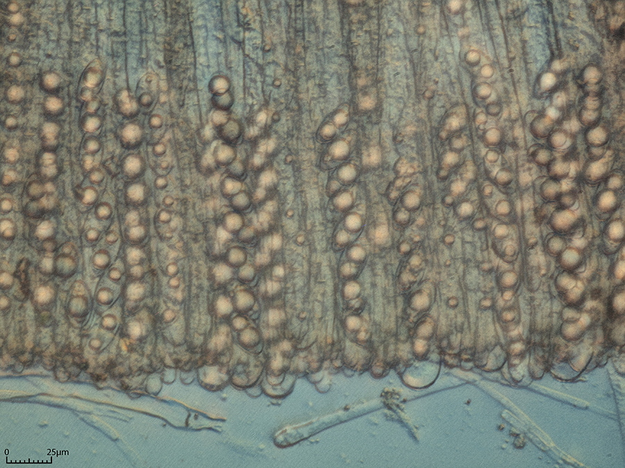 Schlauch mit Sporen Mikroskopobjektiv 40x<br />hier sind die Sporen schon zu erkennen
