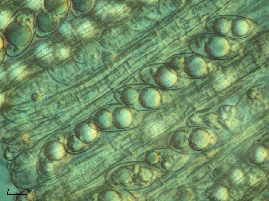 Schlauch mit Sporen Mikroskopobjektiv 100x<br />Die Sporen mit ihren 2 Kernen sind gut zu erkennen